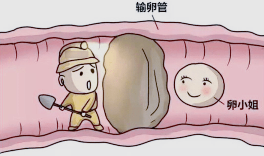 為什麼輸卵管會(huì)堵塞？